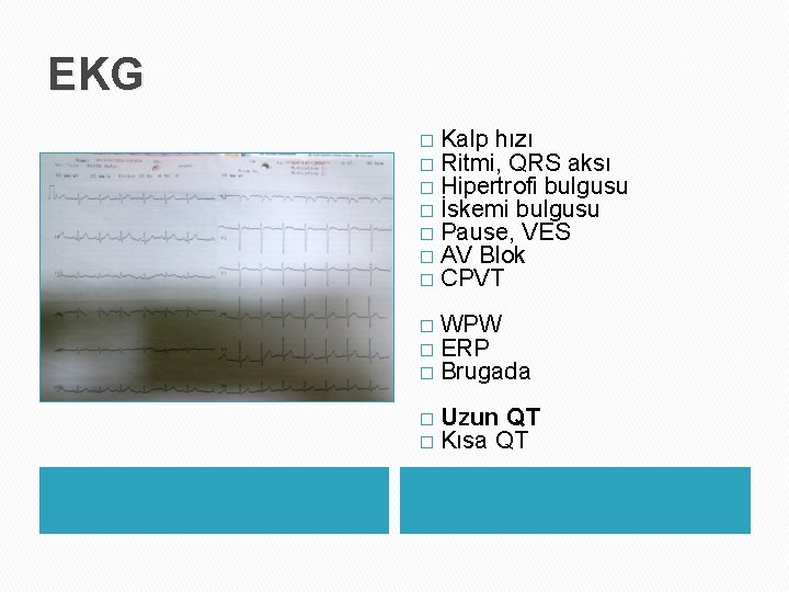 EKG � � � � Kalp hızı Ritmi, QRS aksı Hipertrofi bulgusu İskemi bulgusu