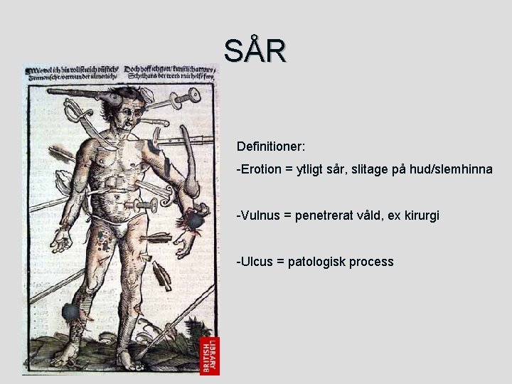 SÅR Definitioner: -Erotion = ytligt sår, slitage på hud/slemhinna -Vulnus = penetrerat våld, ex