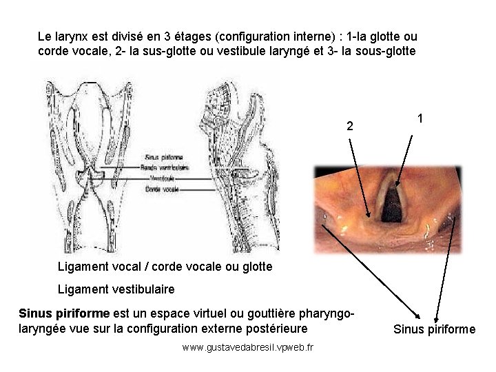 Le larynx est divisé en 3 étages (configuration interne) : 1 -la glotte ou