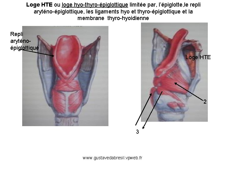 Loge HTE ou loge hyo-thyro-épiglottique limitée par, l’épiglotte, le repli aryténo-épiglottique, les ligaments hyo