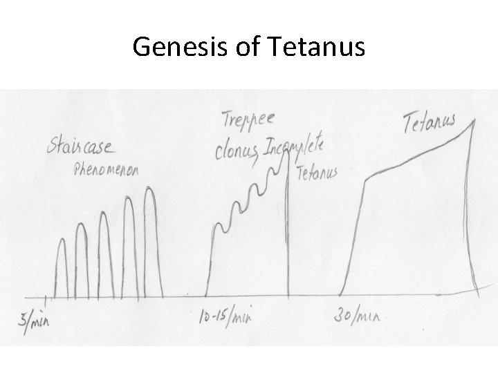 Genesis of Tetanus 