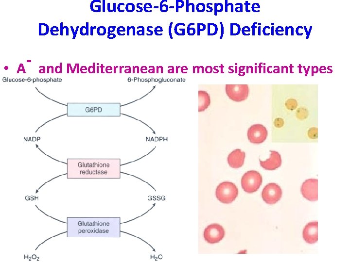 Glucose-6 -Phosphate Dehydrogenase (G 6 PD) Deficiency • A and Mediterranean are most significant