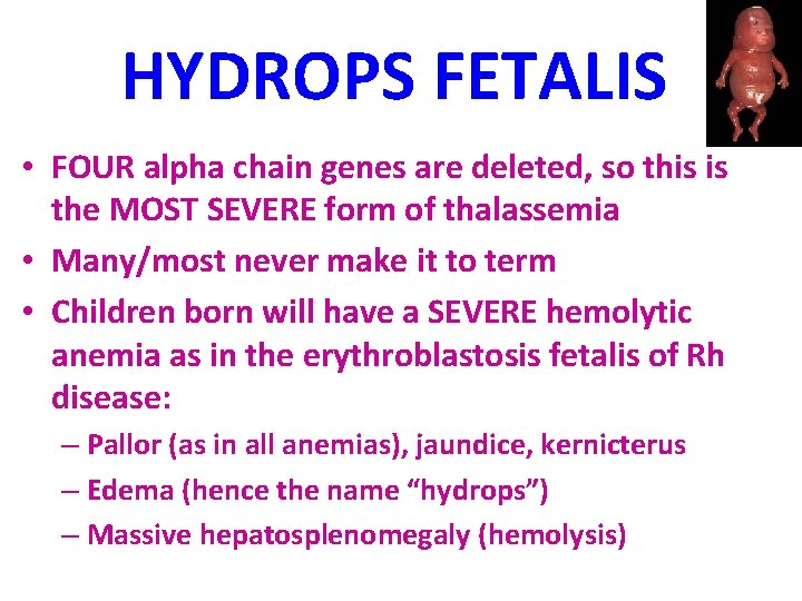 HYDROPS FETALIS • FOUR alpha chain genes are deleted, so this is the MOST