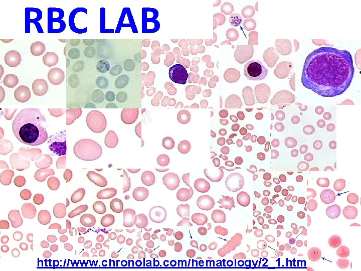 RBC LAB http: //www. chronolab. com/hematology/2_1. htm 