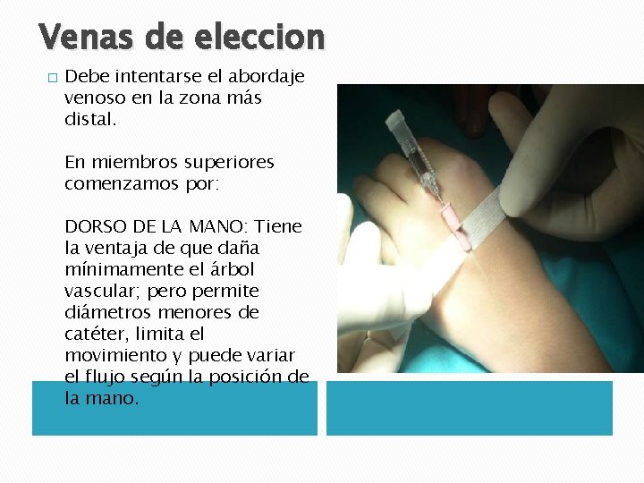 Venas de eleccion � Debe intentarse el abordaje venoso en la zona más distal. Venas de eleccion � Debe intentarse el abordaje venoso en la zona más distal.