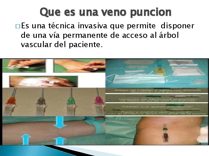 � Es Que es una veno puncion una técnica invasiva que permite disponer de � Es Que es una veno puncion una técnica invasiva que permite disponer de