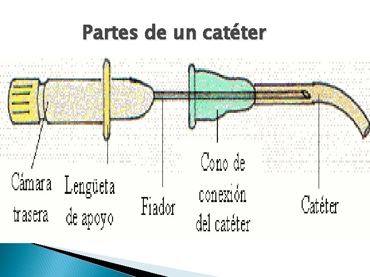 Partes de un catéter Partes de un catéter