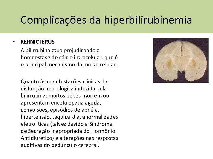 Complicações da hiperbilirubinemia • KERNICTERUS A bilirrubina atua prejudicando a homeostase do cálcio intracelular,