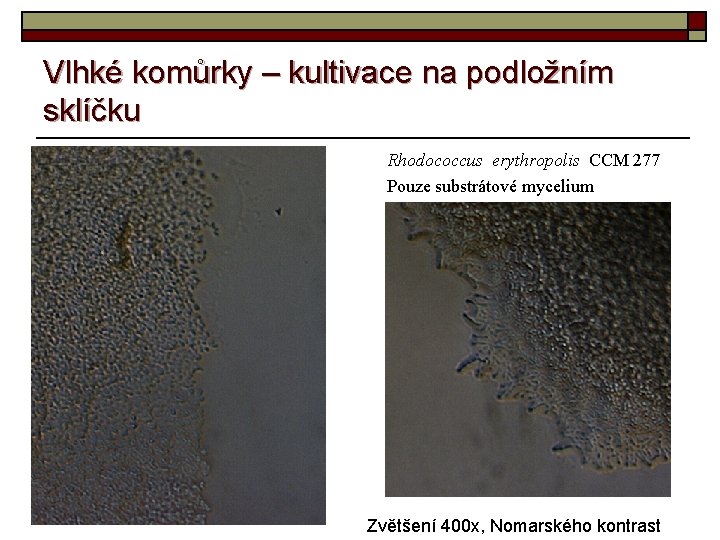 Vlhké komůrky – kultivace na podložním sklíčku Rhodococcus erythropolis CCM 277 Pouze substrátové mycelium