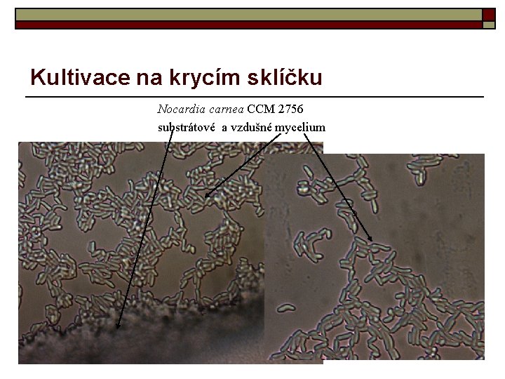 Kultivace na krycím sklíčku Nocardia carnea CCM 2756 substrátové a vzdušné mycelium 