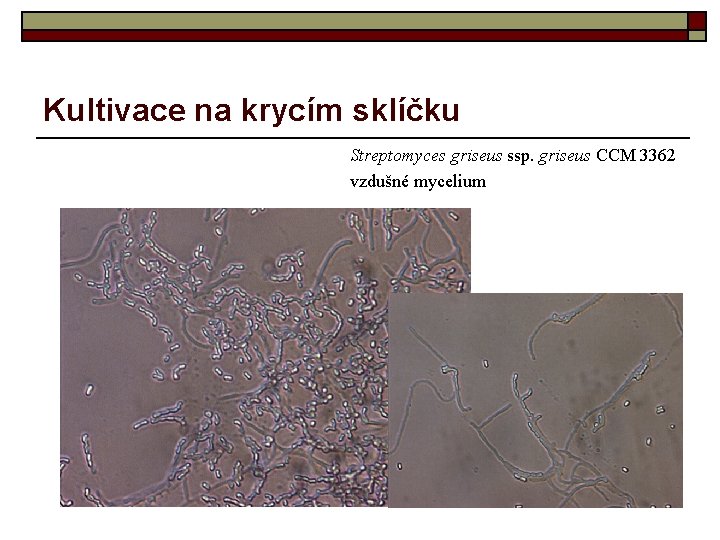 Kultivace na krycím sklíčku Streptomyces griseus ssp. griseus CCM 3362 vzdušné mycelium 