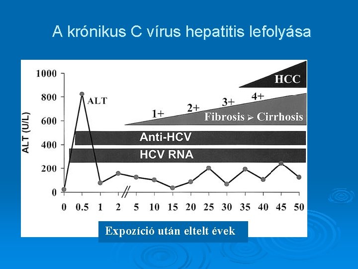 A krónikus C vírus hepatitis lefolyása Expozíció után eltelt évek 