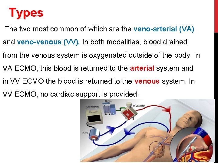 Types The two most common of which are the veno-arterial (VA) and veno-venous (VV).