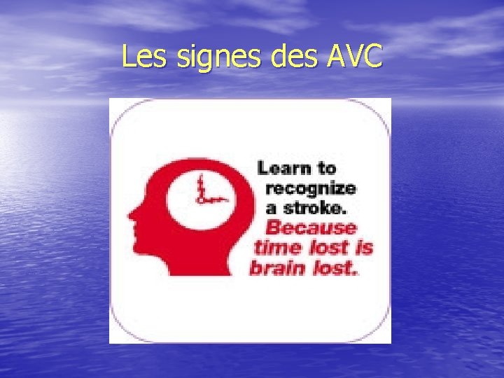 Les signes des AVC 