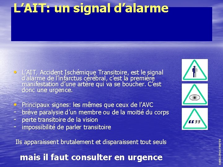 L’AIT: un signal d’alarme • L’AIT, Accident Ischémique Transitoire, est le signal d’alarme de