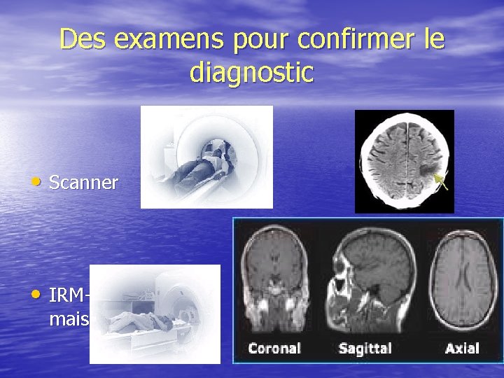 Des examens pour confirmer le diagnostic • Scanner • IRM+++ mais… 