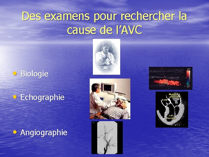 Des examens pour recher la cause de l’AVC • Biologie • Echographie • Angiographie