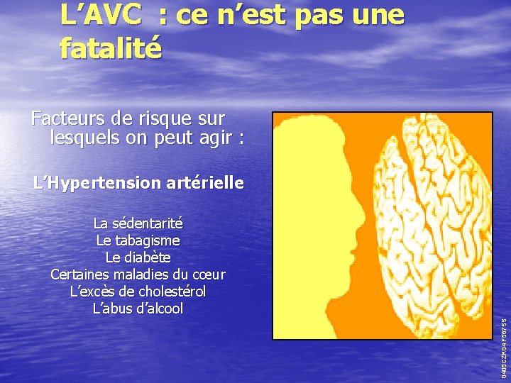 L’AVC : ce n’est pas une fatalité Facteurs de risque sur lesquels on peut