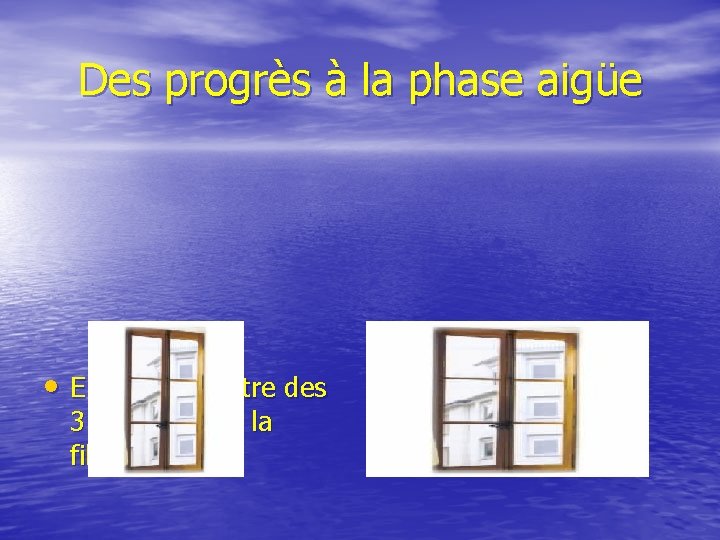 Des progrès à la phase aigüe • Elargir la fenêtre des 3 heures pour