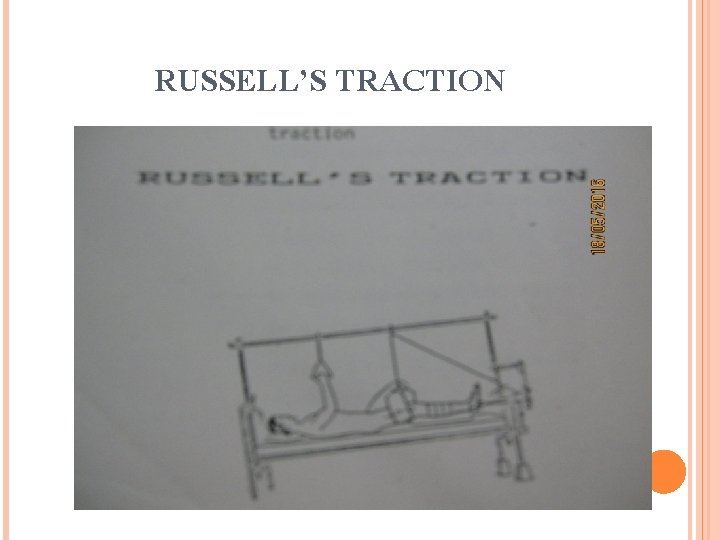 RUSSELL’S TRACTION 