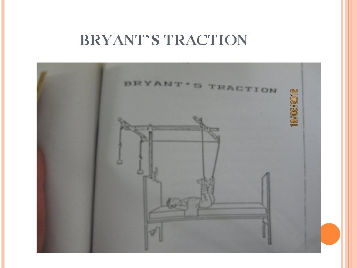 BRYANT’S TRACTION 