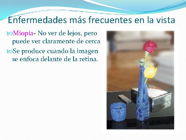 Enfermedades más frecuentes en la vista Miopía- No ver de lejos, pero puede ver