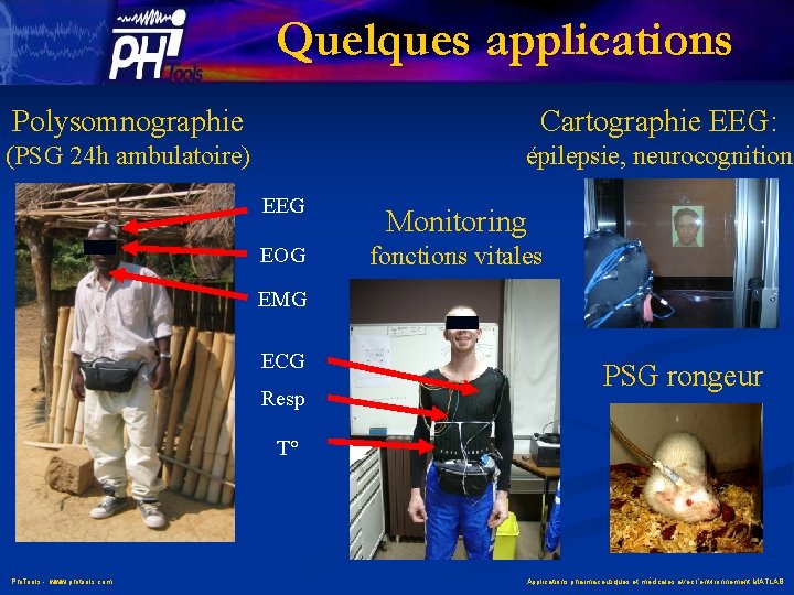 Quelques applications Polysomnographie Cartographie EEG: (PSG 24 h ambulatoire) épilepsie, neurocognition EEG EOG Monitoring