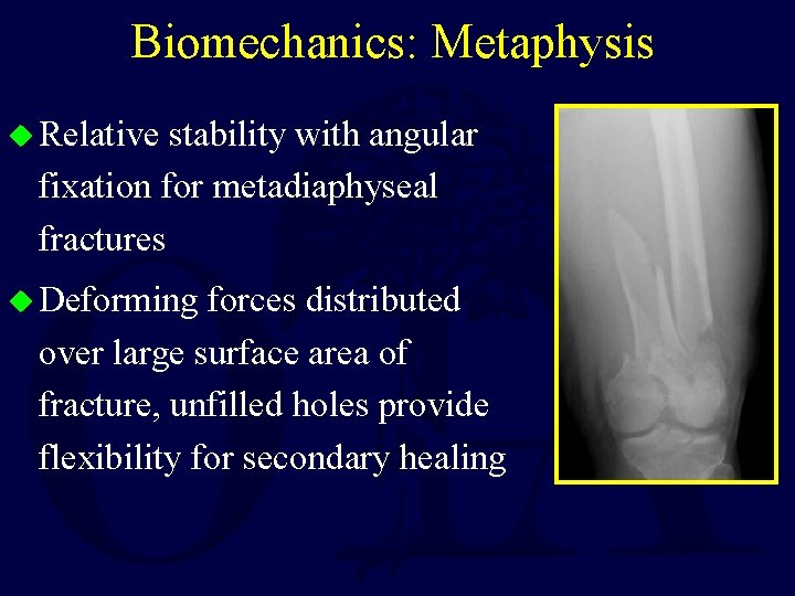 Biomechanics: Metaphysis u Relative stability with angular fixation for metadiaphyseal fractures u Deforming forces