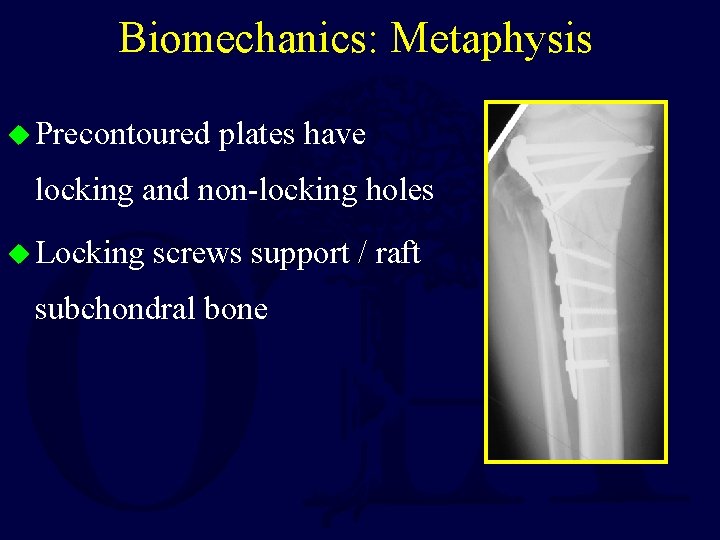 Biomechanics: Metaphysis u Precontoured plates have locking and non-locking holes u Locking screws support