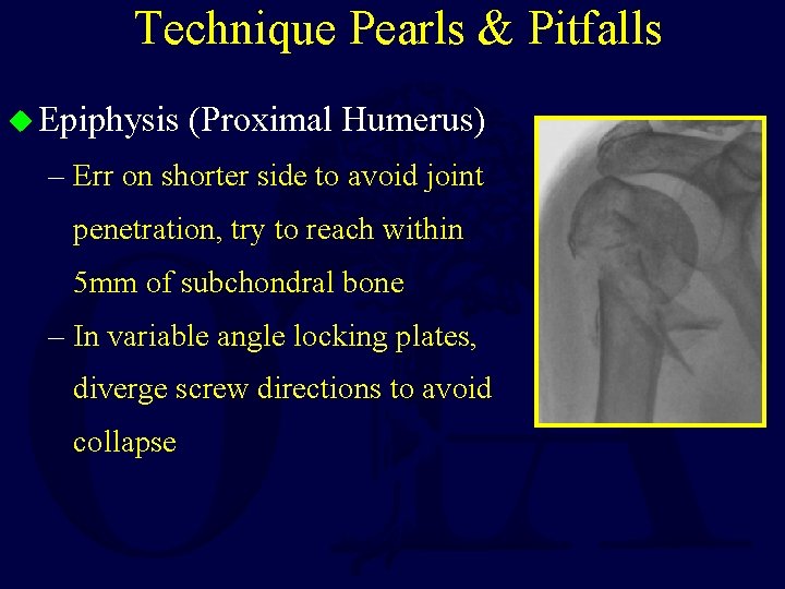 Technique Pearls & Pitfalls u Epiphysis (Proximal Humerus) – Err on shorter side to