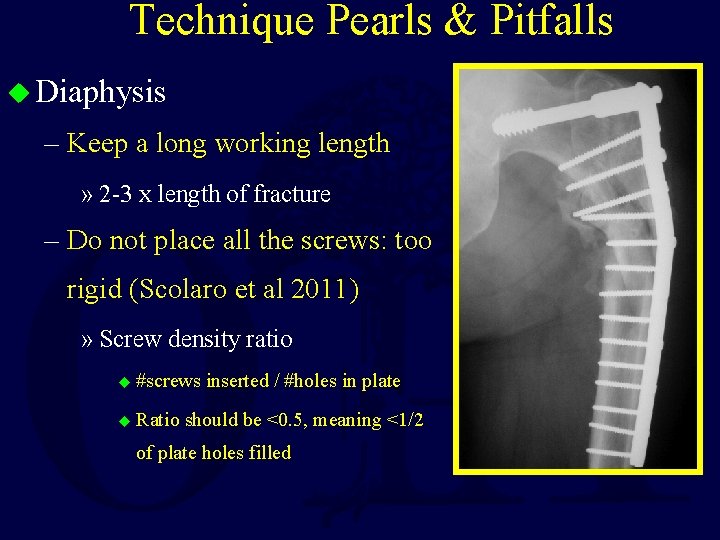 Technique Pearls & Pitfalls u Diaphysis – Keep a long working length » 2