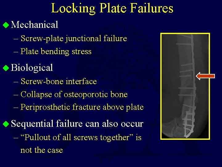 Locking Plate Failures u Mechanical – Screw-plate junctional failure – Plate bending stress u