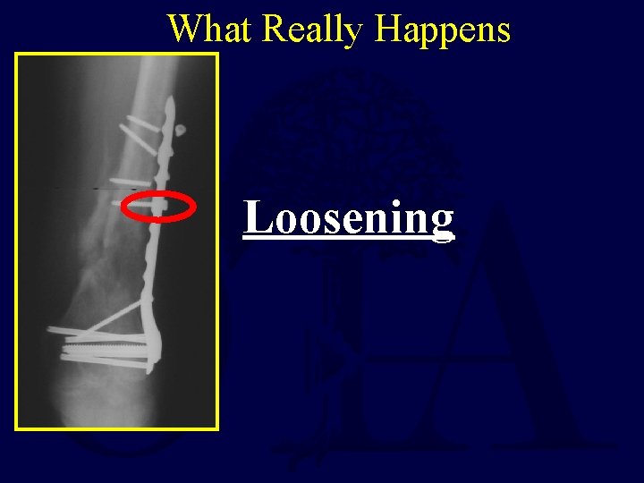 What Really Happens Loosening 