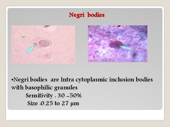 Negri bodies • Negri bodies are Intra cytoplasmic inclusion bodies with basophilic granules Sensitivity