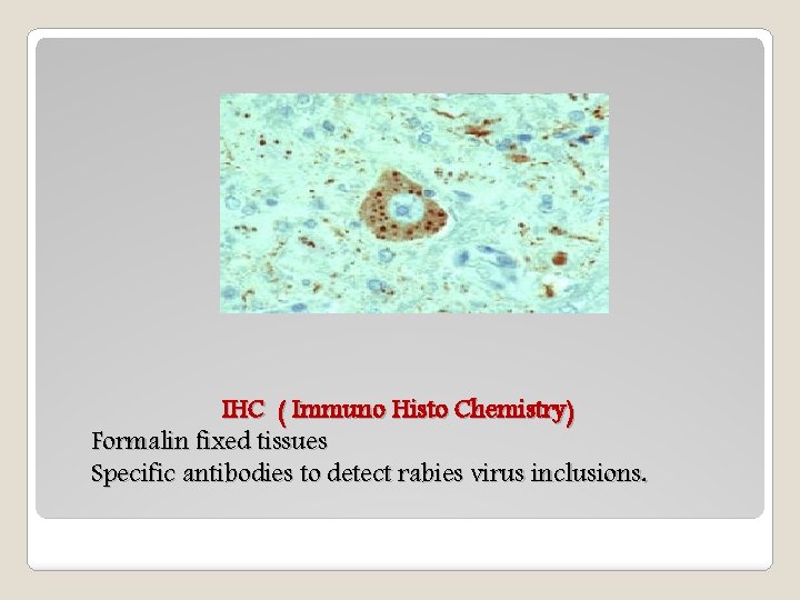 IHC ( Immuno Histo Chemistry) Formalin fixed tissues Specific antibodies to detect rabies virus