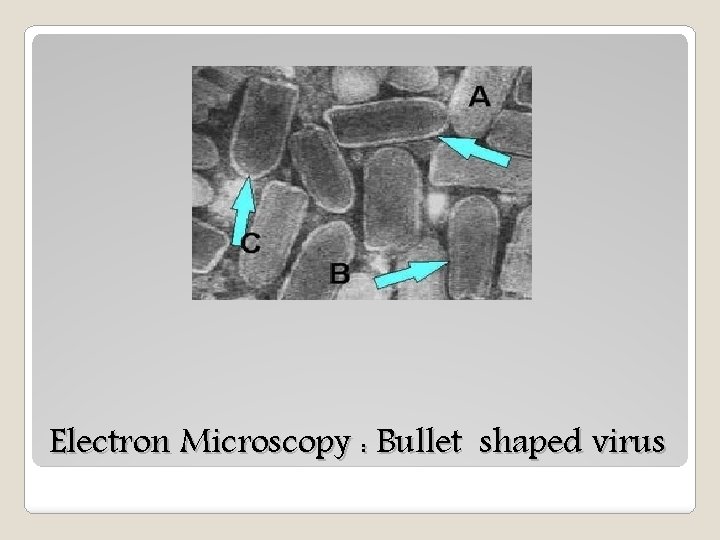 Electron Microscopy : Bullet shaped virus 