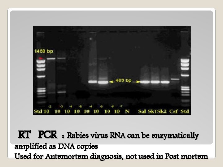RT PCR : Rabies virus RNA can be enzymatically amplified as DNA copies Used