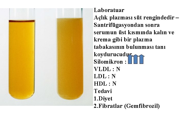 Laboratuar Açlık plazması süt rengindedir – Santrifügasyondan sonra serumun üst kısmında kalın ve krema