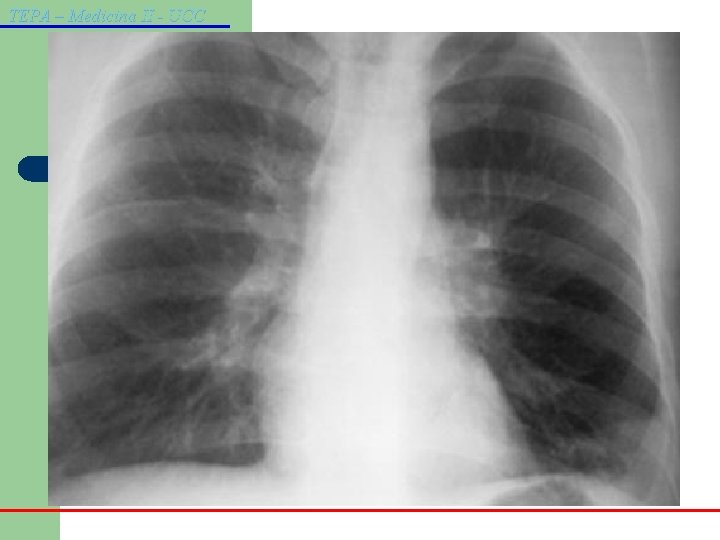 TEPA – Medicina II - UCC 