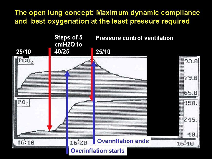 The open lung concept: Maximum dynamic compliance and best oxygenation at the least pressure