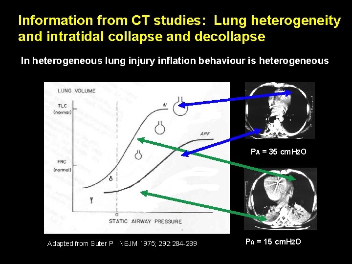 Information from CT studies: Lung heterogeneity and intratidal collapse and decollapse In heterogeneous lung