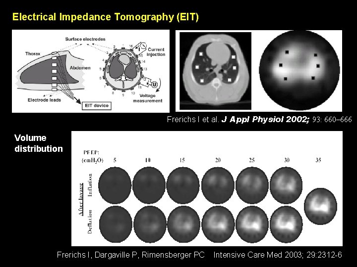 Electrical Impedance Tomography (EIT) Frerichs I et al. J Appl Physiol 2002; 93: 660–