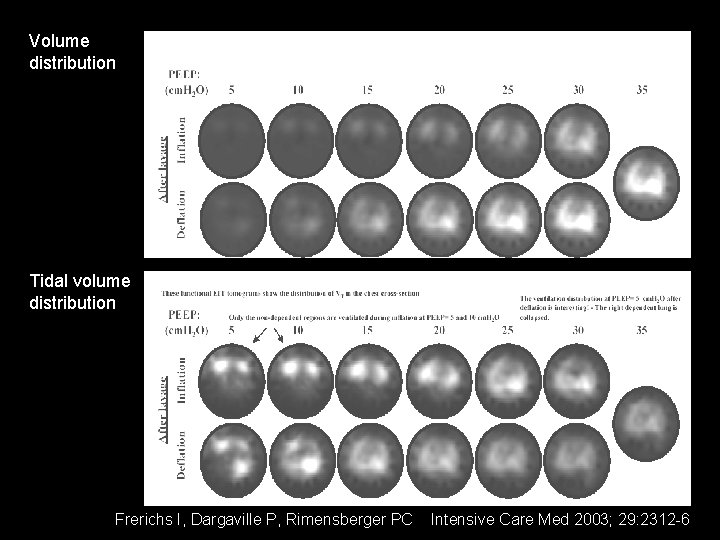 Volume distribution Tidal volume distribution Frerichs I, Dargaville P, Rimensberger PC Intensive Care Med