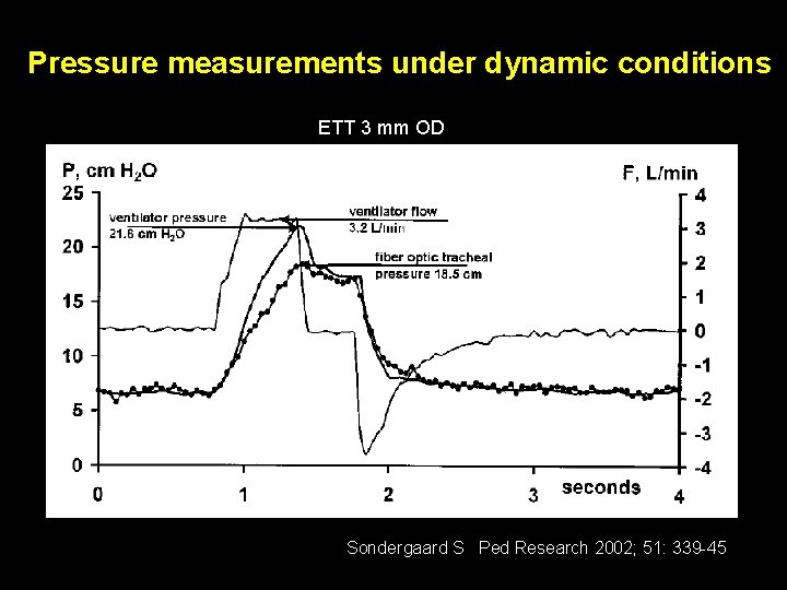 Pressure measurements under dynamic conditions ETT 3 mm OD Sondergaard S Ped Research 2002;