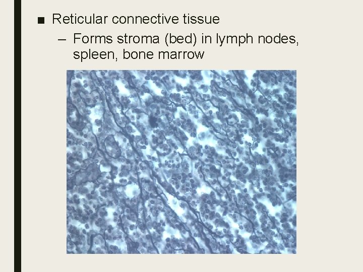 ■ Reticular connective tissue – Forms stroma (bed) in lymph nodes, spleen, bone marrow