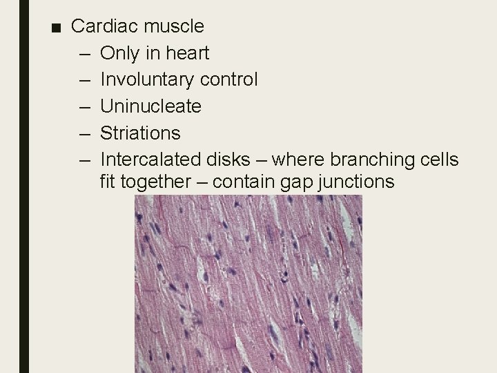 ■ Cardiac muscle – Only in heart – Involuntary control – Uninucleate – Striations