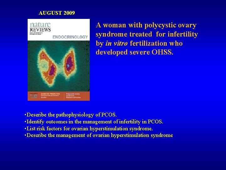 AUGUST 2009 A woman with polycystic ovary syndrome treated for infertility by in vitro