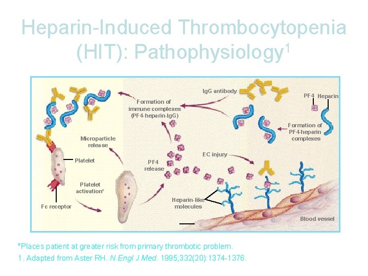 Heparin-Induced Thrombocytopenia (HIT): Pathophysiology 1 Ig. G antibody Formation of immune complexes (PF 4