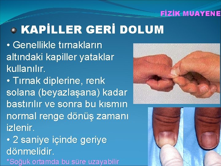 FİZİK MUAYENE KAPİLLER GERİ DOLUM • Genellikle tırnakların altındaki kapiller yataklar kullanılır. • Tırnak