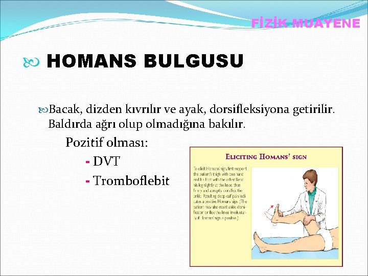 FİZİK MUAYENE HOMANS BULGUSU Bacak, dizden kıvrılır ve ayak, dorsifleksiyona getirilir. Baldırda ağrı olup